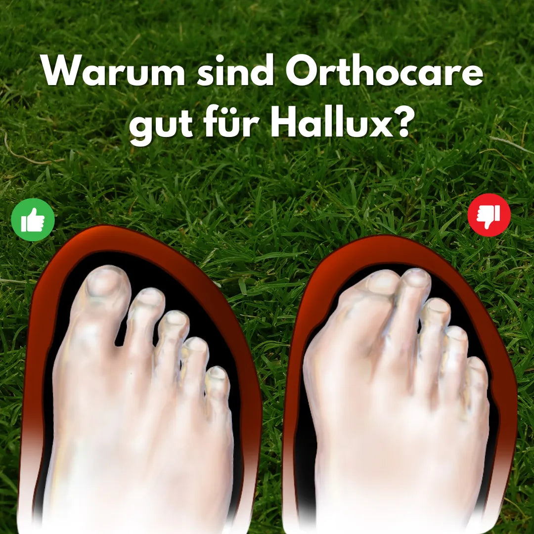 OrthoCare – ergonomische & schmerzlindernde Hallux Valgus Schuhe